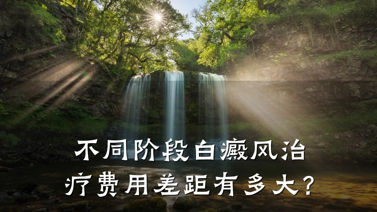 不同阶段白癜风治疗费用差距有多大？